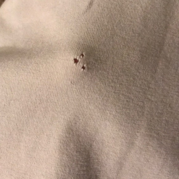 BKE tank - Picture 2 of 2